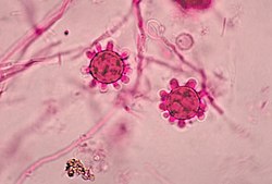 Tuberculate macroconida of the Jamaican isolate of Histoplasma capsulatum PHIL 4023 lores.jpg