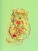 September 12: The rotifer Brachionus calyciflorus