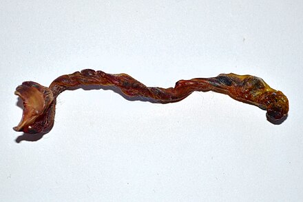 A 7 cm (2.75 in) long detached umbilical cord.