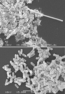 A Bacillus cereus cell that has undergone filamentation following antibacterial treatment (upper electron micrograph; top right) and regularly sized cells of untreated B. cereus (lower electron micrograph) Filamentation 2.jpg