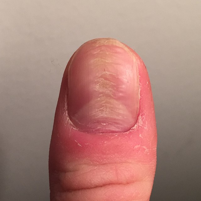 Experts Explain Why You Should Never Cut Your Cuticles | HuffPost Life