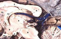 Sagittal section of the brain After opening, the labels of the individual structures are displayed.