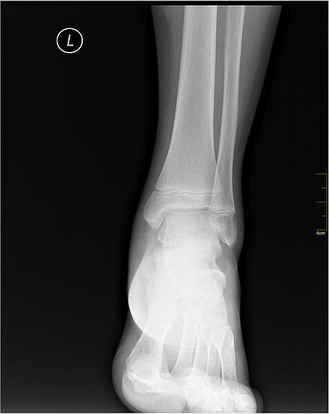 File:Medical X-Ray imaging KFY05 nevit.jpg