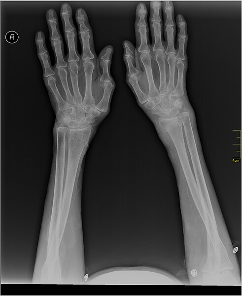 File:Medical X-Ray imaging QBA06 nevit.jpg