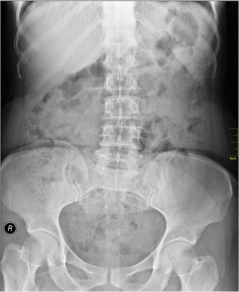 File:Medical X-Ray imaging QQW06 nevit.jpg