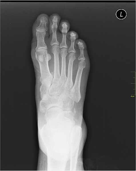 File:Medical X-Ray imaging VLJ07 nevit.jpg