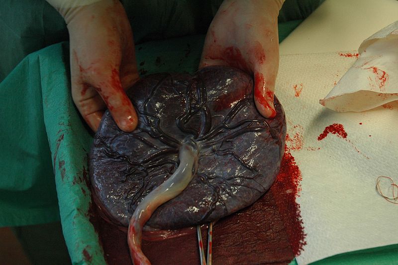 File:Placenta held.jpg