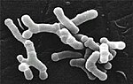 Thumbnail for Bifidobacterium longum