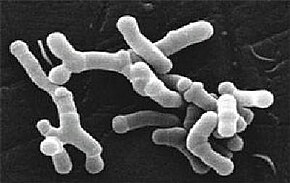 Kuvan kuvaus Bifidobacterium longum elektronimikroskopiassa.jpg.