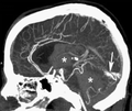 Scansio Tomographica Computata