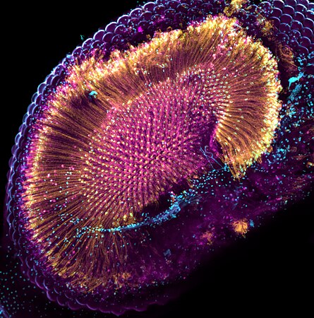 Confocal image of a fruit fly retina expressing a toxic form of the RdgB protein, leading to degeneration. Photo by Guillaume Thuery