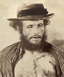 Fred Ward (alias Captain Thunderbolt) Australian bushranger after being shot in 1870.jpg