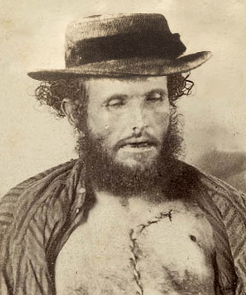 File:Fred Ward (alias Captain Thunderbolt) Australian bushranger after being shot in 1870.jpg