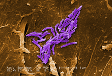 Mycobacterium fortuitum.png