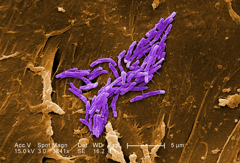 File:Mycobacterium fortuitum.png