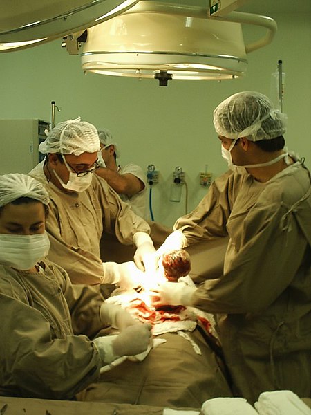 File:Caesarian birth.jpg