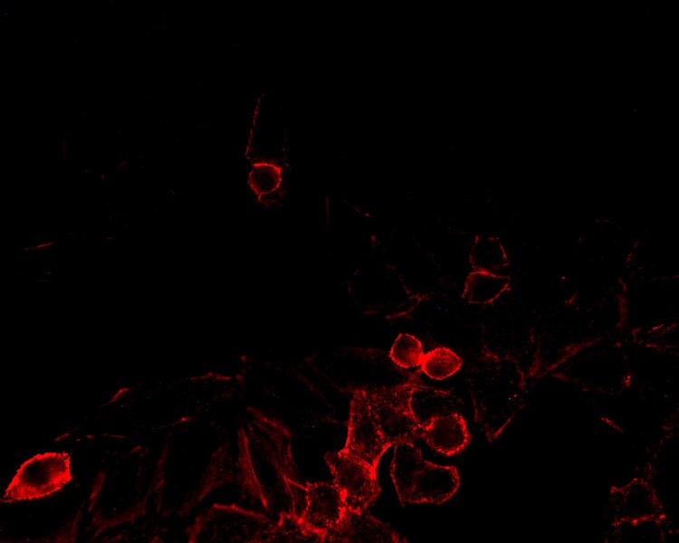 File:F-actin in β cells of pancreas (phaloidin and TRITC) 5.jpg