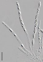 Unitunicaat-inoperculaat sporenzakje met ascosporen van Hypomyces chrysospermus