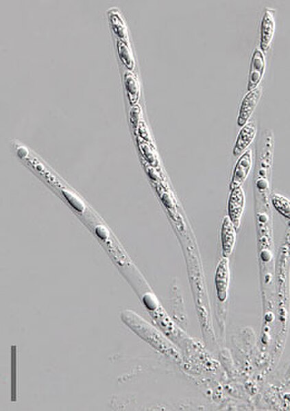 Asci of Hypomyces chrysospermus (they are unitunicate-inoperculate). DIC image.