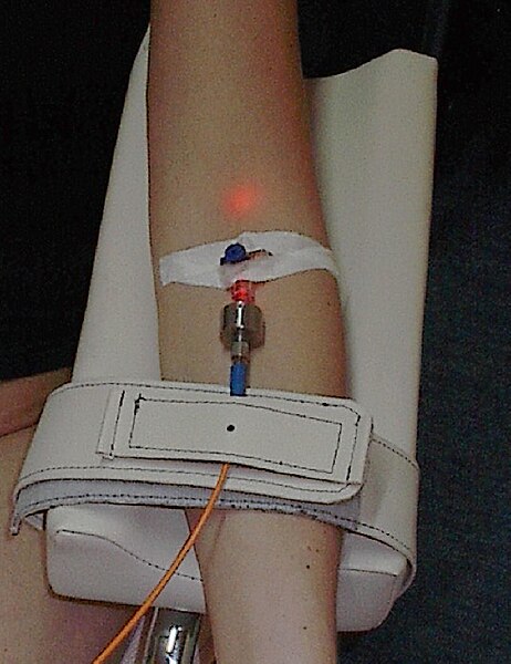 File:Intravenous Blood Irradiation.JPG