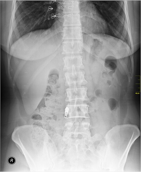 File:Medical X-Ray imaging TMN07 nevit.jpg