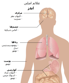 تصویر نیم تنه انسان که در آن شایع‌ترین علائم ایدز مشخص شده است