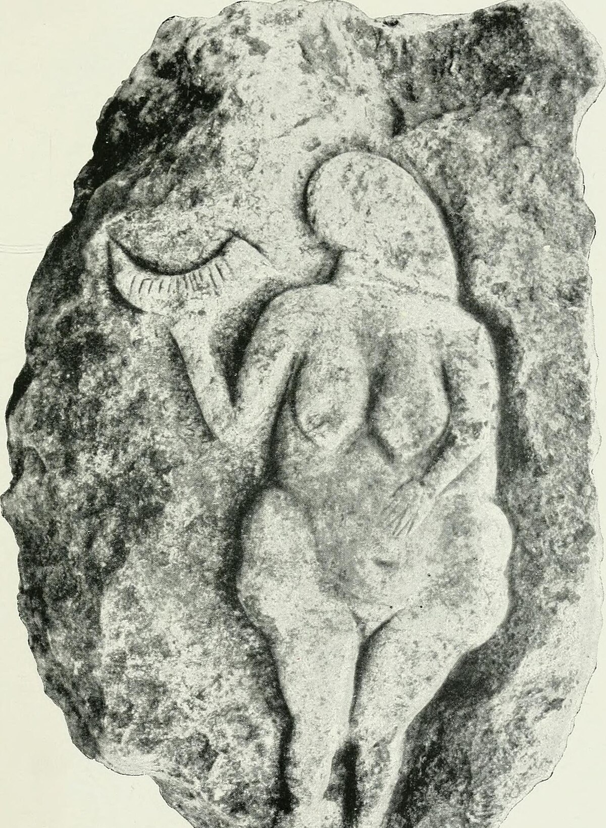 A sketch of 16th a century arm stretcher, an early bone setting