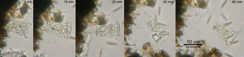 Vorticella w1.jpg