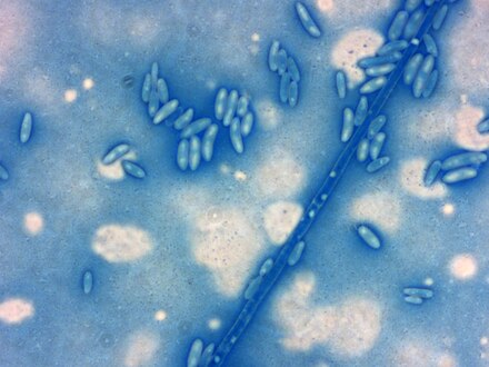 Fusarium oxysporum conidiophores stained by lactophenol cotton blue 2FB 60X8.tif