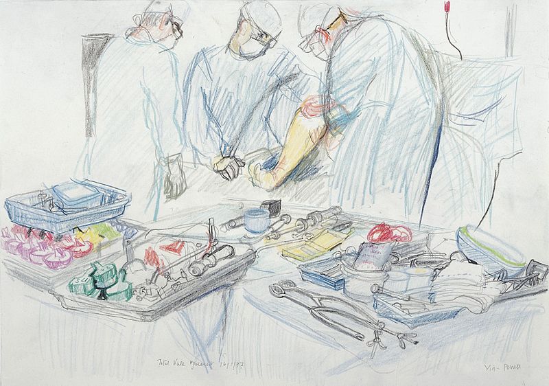 File:A surgical operation; total knee replacement. Drawing by Vir Wellcome L0028360.jpg