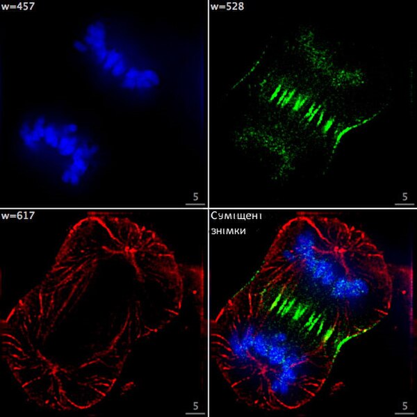 This helps depict the role that microtubules play in cellular division. In this fluorescent image, the microtubules are highlighted green and can be s