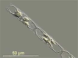 Guinardia delicatula, a diatom responsible for algal blooms in the North Sea and the English Channel[400]