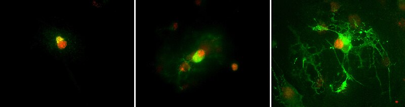 File:Rat oligodendrocyte development Olig2 and CNPase.jpg