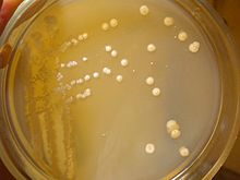 Streptomyces gardneri strain ChNPU F3.jpg
