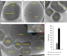 Cryo-ET-Aufnahmen von Ca. S. hospitalis und Ca. M. harzensis.