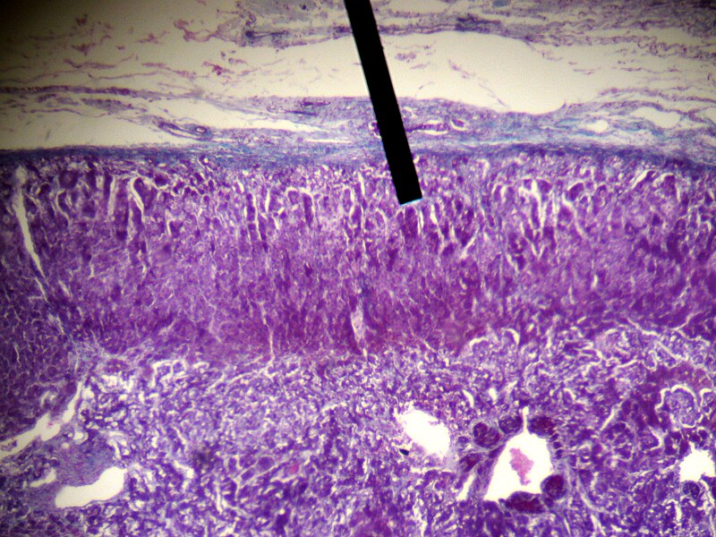 File:Adrenal gland (zona glomerulosa).JPG