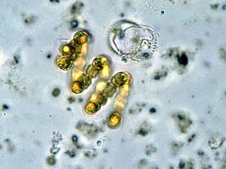 Nostocaceae Family of bacteria