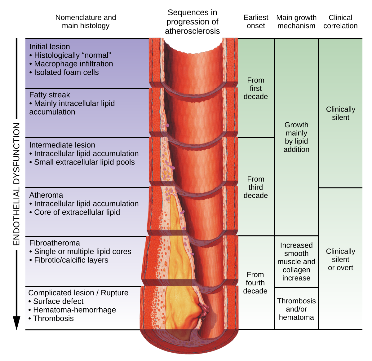 A Definition of Advanced Types of Atherosclerotic Lesions and a  Histological Classification of Atherosclerosis