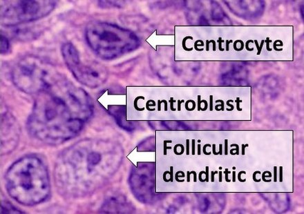 Histologic comparison of cell types in a germinal center, including follicular dendritic cells, H&E stain: - Centrocytes are small to medium size with