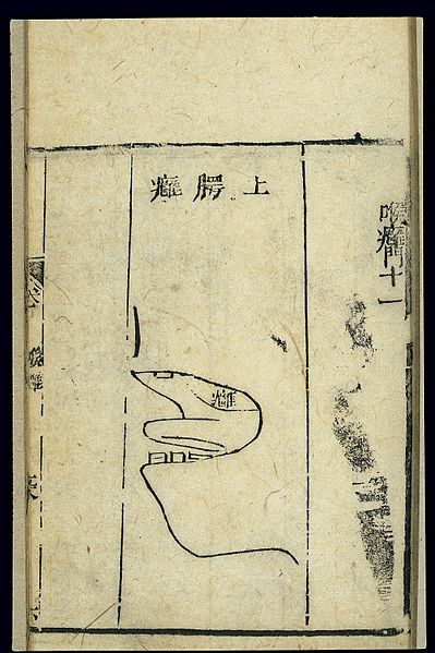 File:Chinese C19 woodcut; Abscesses on the palate Wellcome L0038871.jpg