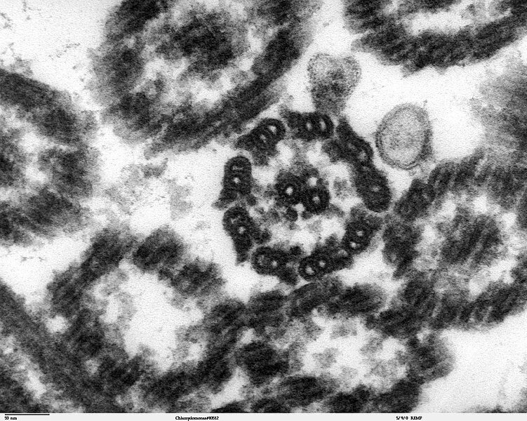 File:Chlamydomonas TEM 15.jpg