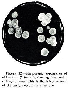 Coccidioides immitis microscopy.jpg