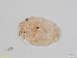 Collection Penard MHNG Specimen 48-3-2 Amphitrema stenostoma.tif