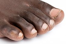 Human toes Foot on white background (cropped).jpg