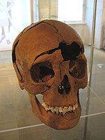 One of the epigraphs entails an ancient scalped skull. Frauenschadel Regensburg-Harting.jpg
