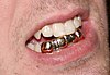 A gold dental grill