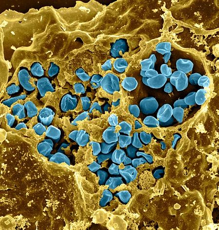 Macrophage Infected with Francisella tularensis Bacteria (5950310835).jpg
