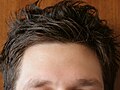 Male forehead-01 ies.jpg