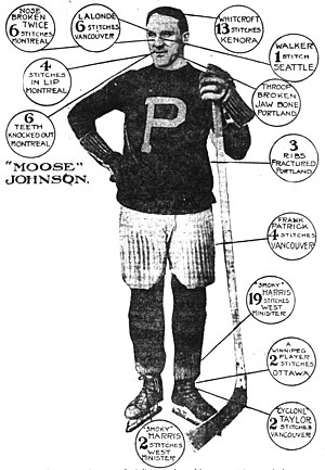 A diagram of injuries suffered by Johnson from the January 30, 1916 edition of The Oregon Daily Journal Moose Johnson Portland.jpeg