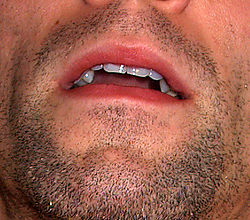 Mouth by David Shankbone.jpg